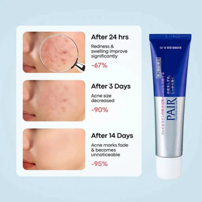 LION Pair Acne Medicated Acne Care Cream 24g